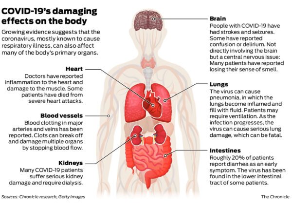 Why COVID-19 Is Nothing Like the Flu – and Why We Should Take It Seriously