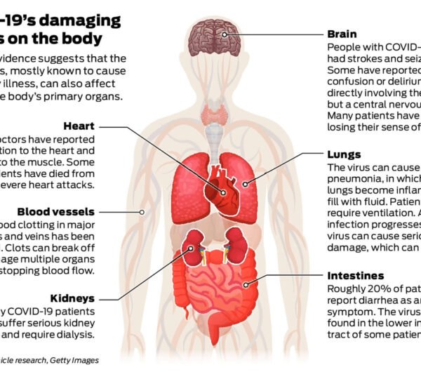 Why COVID-19 Is Nothing Like the Flu – and Why We Should Take It Seriously
